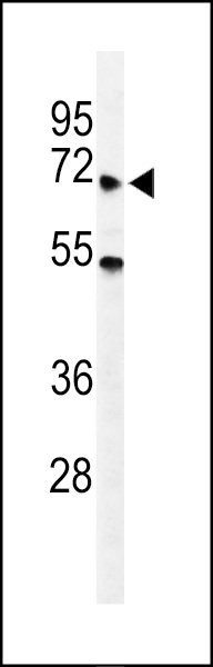 Western blot analysis of YTHD3 Antibody (Center) (Cat. #AP9985a) in A549 cell line lysates (35ug/lane). YTHD3 (arrow) was detected using the purified Pab.