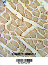 YTHD3 Antibody (Center) (Cat. #AP9985a) IHC analysis in formalin fixed and paraffin embedded skeletal muscle followed by peroxidase conjugation of the secondary antibody and DAB staining. This data demonstrates the use of the YTHD3 Antibody (Center) for immunohistochemistry. Clinical relevance has not been evaluated.