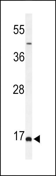 Western blot analysis of FAM44B Antibody (C-term) (Cat. #AP9969a) in MCF-7 cell line lysates (35ug/lane). FAM44B (arrow) was detected using the purified Pab.