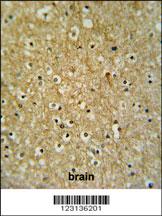 CIRH1A Antibody (N-term) (Cat. #AP9951a) IHC analysis in formalin fixed and paraffin embedded brain tissue followed by peroxidase conjugation of the secondary antibody and DAB staining. This data demonstrates the use of the CIRH1A Antibody (N-term) for immunohistochemistry. Clinical relevance has not been evaluated.