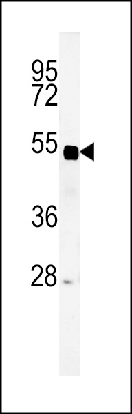 Western blot analysis of SP5 Antibody (C-term) (Cat. #AP9937b) in mouse liver tissue lysates (35ug/lane).SP5 (arrow) was detected using the purified Pab.