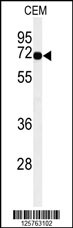 Western blot analysis of MFSD6 Antibody (C-term) (Cat. #AP9932b) in CEM cell line lysates (35ug/lane). MFSD6 (arrow) was detected using the purified Pab.