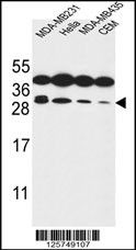 STX10 Antibody (N-term) (Cat. #AP9929a) western blot analysis in MDA-MB231,Hela,MDA-MB435,CEM cell line lysates (35ug/lane).This demonstrates the STX10 antibody detected the STX10 protein (arrow).