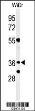 Western blot analysis of NSE4A Antibody (N-term) (Cat. #AP9909a) in WiDr cell line lysates (35ug/lane). NSE4A (arrow) was detected using the purified Pab.