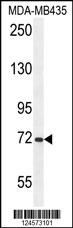 ARHGAP10 Antibody (Center) (Cat. #AP10695b) western blot analysis in MDA-MB435 cell line lysates (35ug/lane).This demonstrates the ARHGAP10 antibody detected the ARHGAP10 protein (arrow).