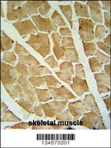 ARHGAP10 antibody (Center) (Cat. #AP10695b) immunohistochemistry analysis in formalin fixed and paraffin embedded human skeletal muscle followed by peroxidase conjugation of the secondary antibody and DAB staining. This data demonstrates the use of the ARHGAP10 antibody (Center) for immunohistochemistry. Clinical relevance has not been evaluated.