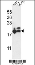 RPL17 Antibody (C-term) (Cat. #AP9892b) western blot analysis in A375,HL-60 cell line lysates (35ug/lane).This demonstrates the RPL17 antibody detected the RPL17 protein (arrow).