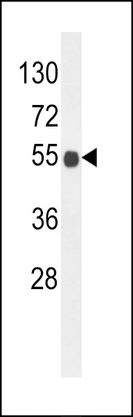 Western blot analysis of B3GNT6 Antibody (Center) (Cat. #AP9886c) in mouse brain tissue lysates (35ug/lane). B3GNT6 (arrow) was detected using the purified Pab.
