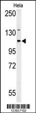 Western blot analysis of ADCY4 Antibody (Center)（Cat. #AP9875c) in Hela cell line lysates (35ug/lane). ADCY4 (arrow) was detected using the purified Pab.