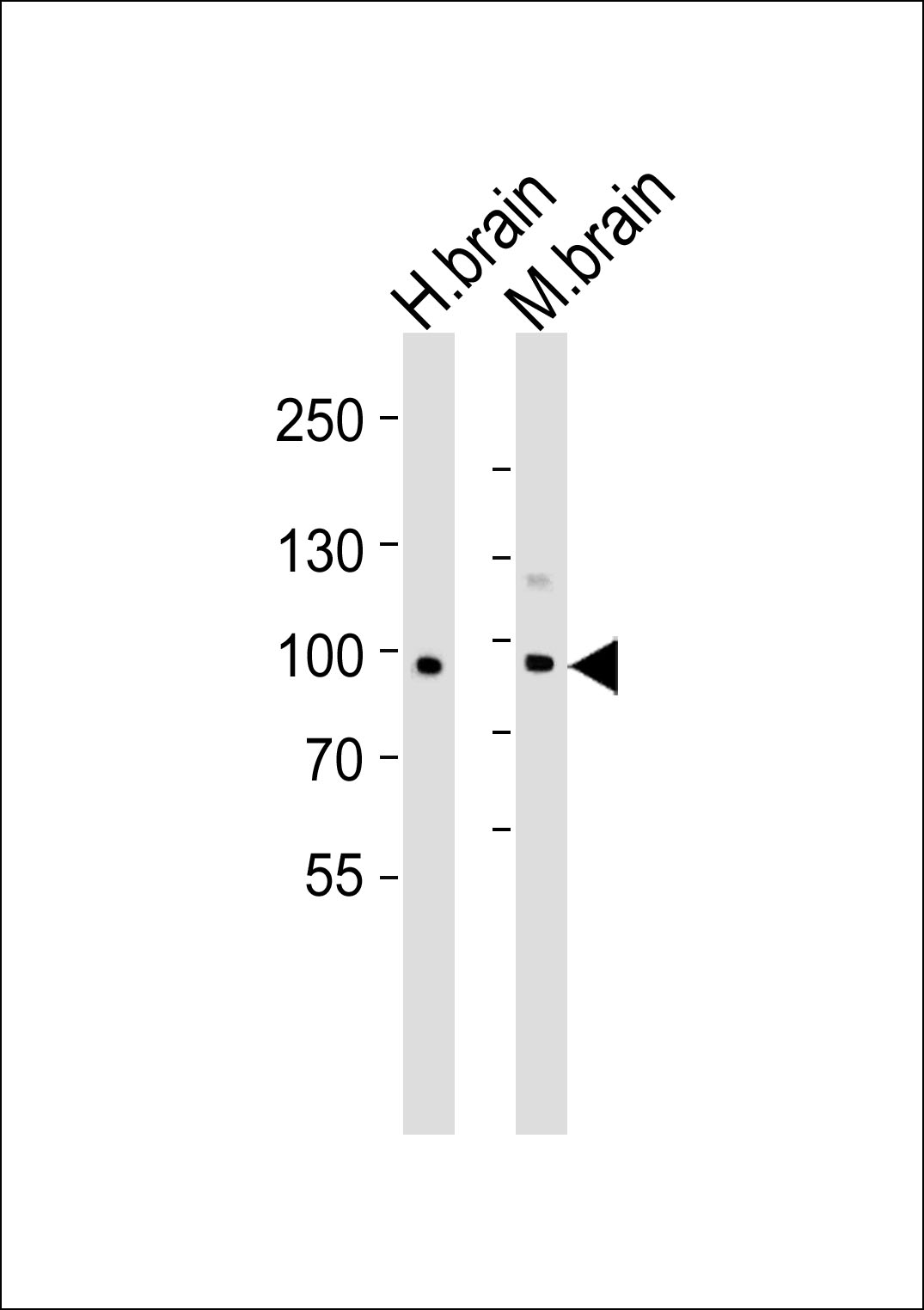 Western blot analysis of lysates from human brain and mouse brain tissue lysate(from left to right), using CDH20 Antibody (N-term)(Cat. #AP9870a). AP9870a was diluted at 1:1000 at each lane. A goat anti-rabbit IgG H&L(HRP) at 1:5000 dilution was used as the secondary antibody. Lysates at 35ug per lane.