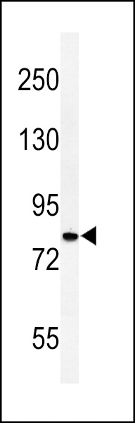 Western blot analysis of CDH20 Antibody (N-term) (Cat. #AP9870a) in HepG2 cell line lysates (35ug/lane). CDH20 (arrow) was detected using the purified Pab.