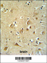 CDH20 Antibody (N-term) (Cat. #AP9870a) IHC analysis in formalin fixed and paraffin embedded brain tissue followed by peroxidase conjugation of the secondary antibody and DAB staining. This data demonstrates the use of the CDH20 Antibody (N-term) for immunohistochemistry. Clinical relevance has not been evaluated.