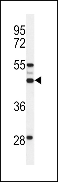Western blot analysis of OSTalpha Antibody (C-term) (Cat. #AP9838b) in 293 cell line lysates (35ug/lane). OST alpha (arrow) was detected using the purified Pab.