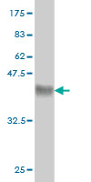 Antibody Reactive Against Recombinant Protein.Western Blot detection against Immunogen (36.63 KDa) .