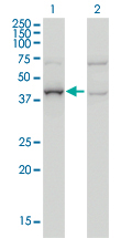 Western Blot analysis of ARMC8 expression in transfected 293T cell line by ARMC8 monoclonal antibody (M01), clone 2D9.Lane 1: ARMC8 transfected lysate(43 KDa).Lane 2: Non-transfected lysate.