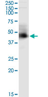 Immunoprecipitation of ARMC8 transfected lysate using anti-ARMC8 monoclonal antibody and Protein A Magnetic Bead (U0007), and immunoblotted with ARMC8 monoclonal antibody.