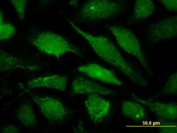 Immunofluorescence of monoclonal antibody to ALG6 on HeLa cell . [antibody concentration 10 ug/ml]