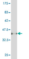 Antibody Reactive Against Recombinant Protein.Western Blot detection against Immunogen (37.84 KDa) . 