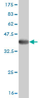 Antibody Reactive Against Recombinant Protein.Western Blot detection against Immunogen (37.62 KDa) . 