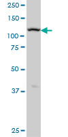ADAMTS17 monoclonal antibody (M01), clone 3B7 Western Blot analysis of ADAMTS17 expression in A-431 ( (Cat # AT1048a )