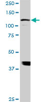 ADAMTS17 monoclonal antibody (M01), clone 3B7. Western Blot analysis of ADAMTS17 expression in NIH/3T3 ( (Cat # AT1048a )