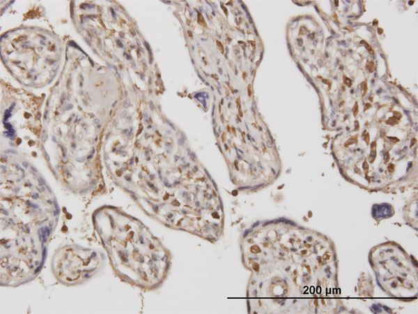 Immunoperoxidase of monoclonal antibody to ADAMTS17 on formalin-fixed paraffin-embedded human placenta. [antibody concentration 1.2 ug/ml]