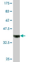 Antibody Reactive Against Recombinant Protein.Western Blot detection against Immunogen (37.84 KDa) . 