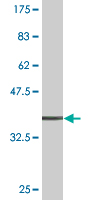 Antibody Reactive Against Recombinant Protein.Western Blot detection against Immunogen (37.84 KDa) . 