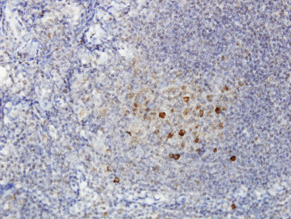 Immunoperoxidase of monoclonal antibody to ADAMDEC1 on formalin-fixed paraffin-embedded human tonsil. [antibody concentration 3 ug/ml]