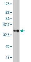 Antibody Reactive Against Recombinant Protein.Western Blot detection against Immunogen (37.18 KDa) . 