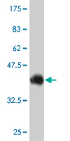 Antibody Reactive Against Recombinant Protein.Western Blot detection against Immunogen (36.74 KDa) . 