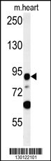 LRRC36 Antibody (N-term) (Cat. #AP10657a) western blot analysis in mouse heart tissue lysates (35ug/lane).This demonstrates the LRRC36 antibody detected the LRRC36 protein (arrow).