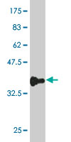 Antibody Reactive Against Recombinant Protein.Western Blot detection against Immunogen (33.11 KDa) . 