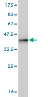 Antibody Reactive Against Recombinant Protein.Western Blot detection against Immunogen (36.63 KDa) . 