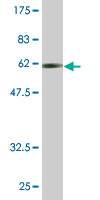 Antibody Reactive Against Recombinant Protein.Western Blot detection against Immunogen (62.81 KDa) . 