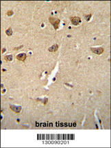 CPLX3 Antibody (Center) (Cat. #AP10652c) immunohistochemistry analysis in formalin fixed and paraffin embedded human brain tissue followed by peroxidase conjugation of the secondary antibody and DAB staining. This data demonstrates the use of the CPLX3 Antibody (Center) for immunohistochemistry. Clinical relevance has not been evaluated.