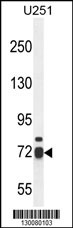 WDR76 Antibody (C-term) (Cat. #AP10651b) western blot analysis in U251 cell line lysates (35ug/lane).This demonstrates the WDR76 antibody detected the WDR76 protein (arrow).