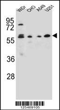 CEP70 Antibody (Center) (Cat. #AP10646c) western blot analysis in WiDr,CHO,A549,U251 cell line lysates (35ug/lane).This demonstrates the CEP70 antibody detected the CEP70 protein (arrow).