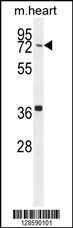 CCDC38 Antibody (Center) (Cat. #AP10644c) western blot analysis in mouse heart tissue lysates (35ug/lane).This demonstrates the CCDC38 antibody detected the CCDC38 protein (arrow).