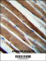 CCDC38 Antibody (Center) (Cat. #AP10644c) immunohistochemistry analysis in formalin fixed and paraffin embedded human skeletal muscle followed by peroxidase conjugation of the secondary antibody and DAB staining. This data demonstrates the use of the CCDC38 Antibody (Center) for immunohistochemistry. Clinical relevance has not been evaluated.