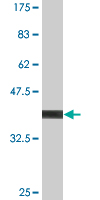 Antibody Reactive Against Recombinant Protein.Western Blot detection against Immunogen (41.8 KDa) . 