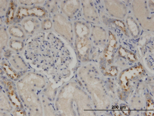 Immunoperoxidase of monoclonal antibody to CALML5 on formalin-fixed paraffin-embedded human kidney. [antibody concentration 3 ug/ml]