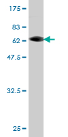 Antibody Reactive Against Recombinant Protein.Western Blot detection against Immunogen (62.81 KDa) . 