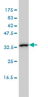 CAB39L monoclonal antibody (M01), clone 3B11-1A4 Western Blot analysis of CAB39L expression in K-562 ( (Cat # AT1360a )