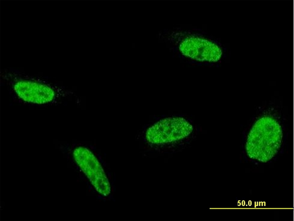 Immunofluorescence of monoclonal antibody to C9orf86 on HeLa cell . [antibody concentration 10 ug/ml]