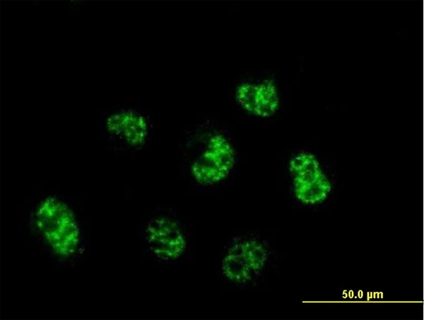Immunofluorescence of monoclonal antibody to C6orf139 on HeLa cell . [antibody concentration 10 ug/ml]