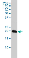 C22orf18 monoclonal antibody (M01), clone 4C12-2C8 Western Blot analysis of C22orf18 expression in K-562 ( (Cat # AT1344a )