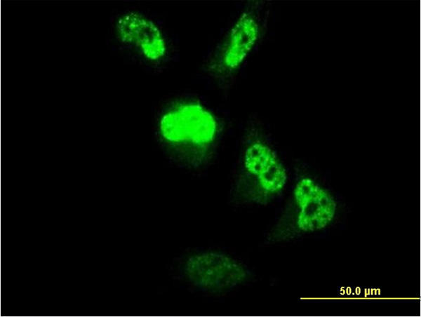 Immunofluorescence of monoclonal antibody to MGC861 on HeLa cell. [antibody concentration 10 ug/ml]