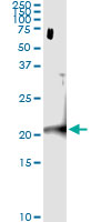 Immunoprecipitation of CENPM transfected lysate using anti-CENPM monoclonal antibody and Protein A Magnetic Bead (U0007), and immunoblotted with CENPM MaxPab rabbit polyclonal antibody.