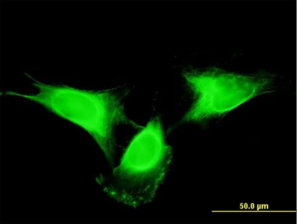 Immunofluorescence of monoclonal antibody to C19orf10 on HeLa cell . [antibody concentration 10 ug/ml]